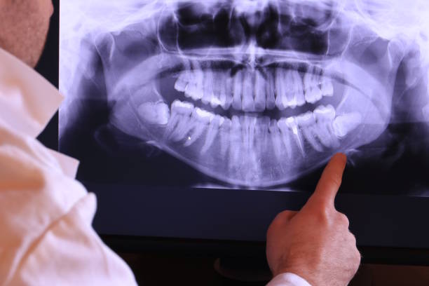 Best Chipped Tooth Repair Near Me  in Lexington, NC