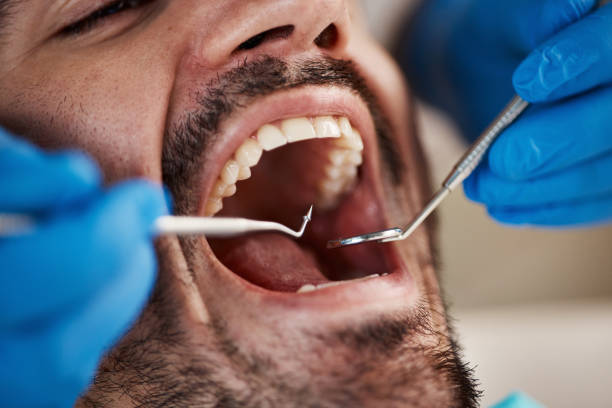 Reliable NC Emergency Dentist Solutions